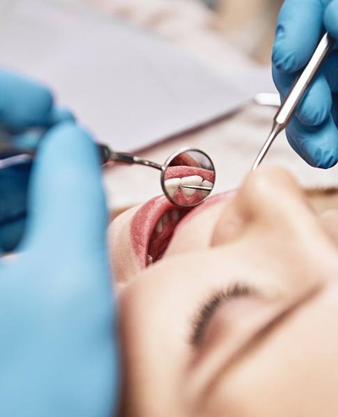 Hygienist performing a dental exam on a patient